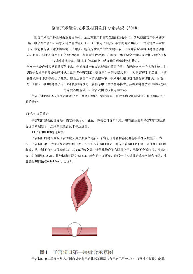 2018年剖宫产术缝合技术及材料选择专家共识