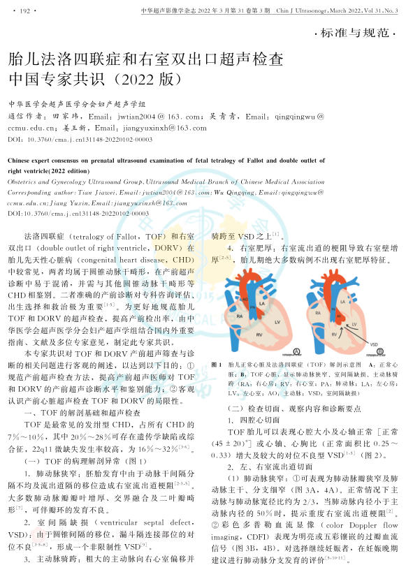 2022年胎儿法洛四联症和右室双出口超声检查中国专家共识