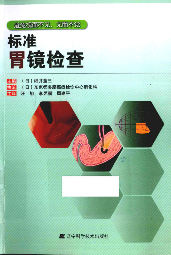 标准胃镜检查