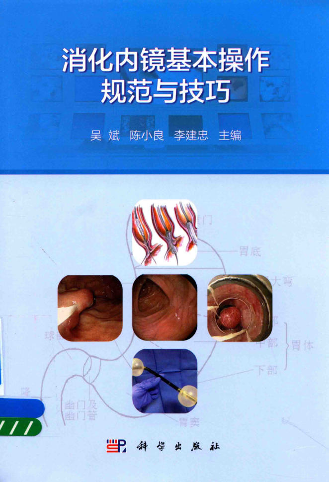 消化内镜基本操作规范与技巧