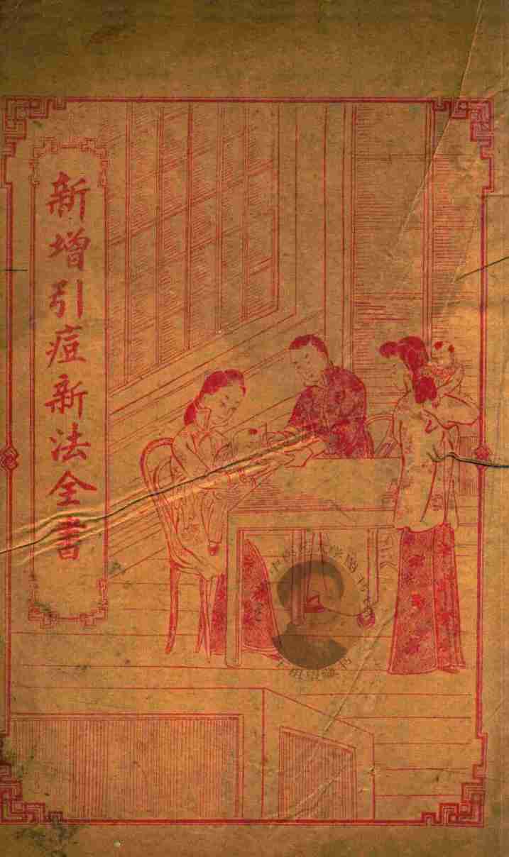 引痘略