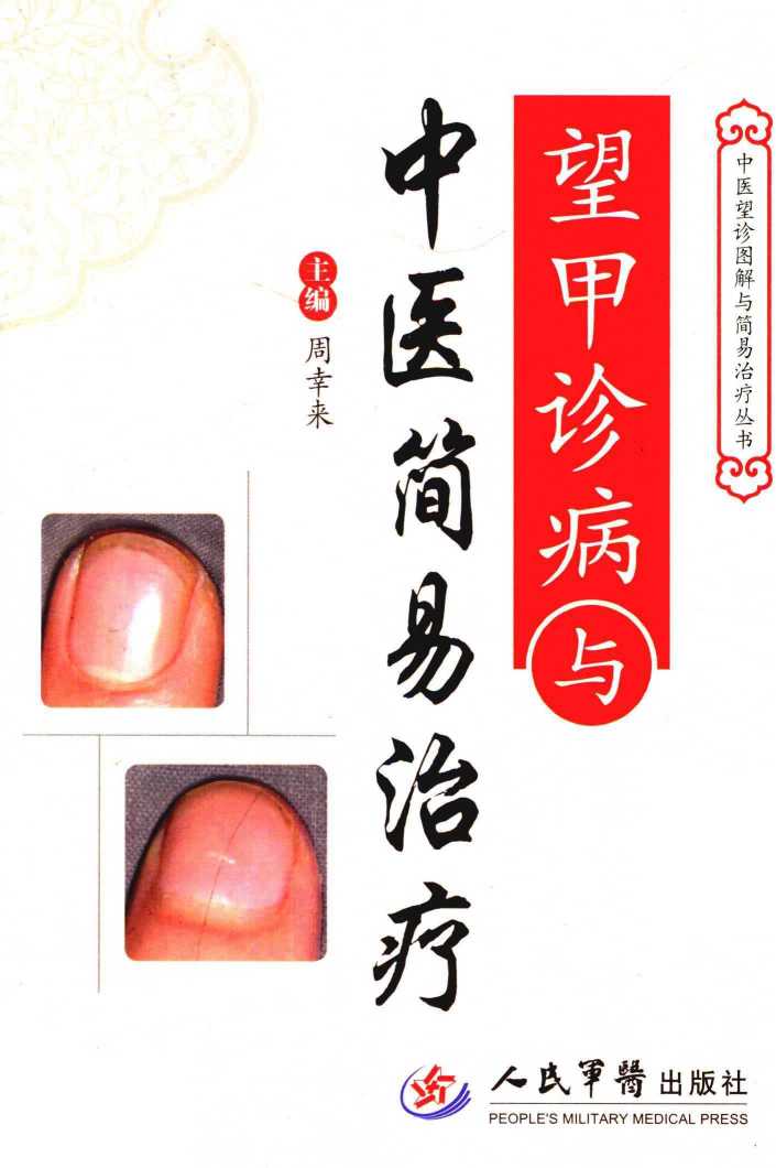 望甲诊病与中医简易治疗