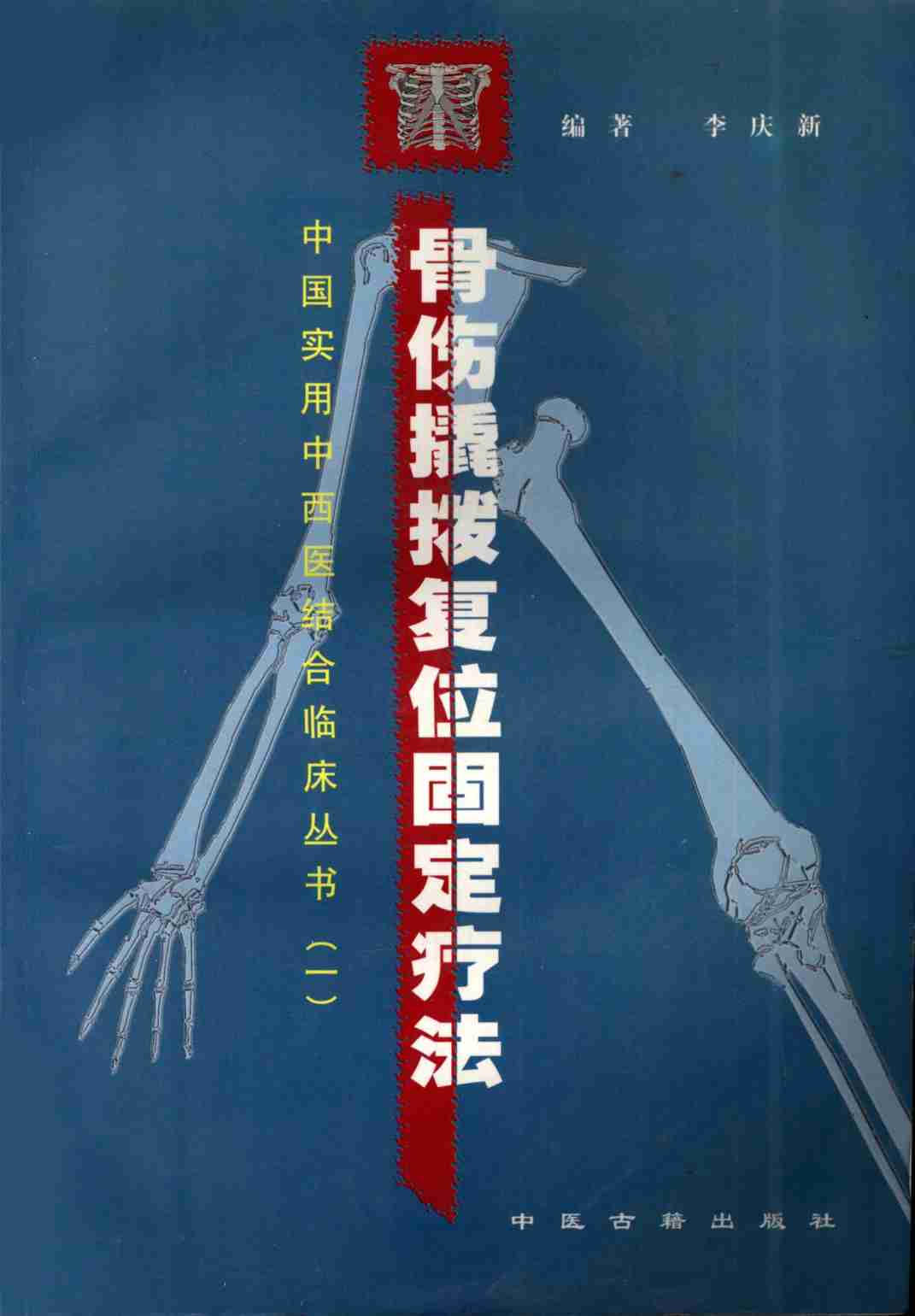 骨伤撬拨复位固定疗法