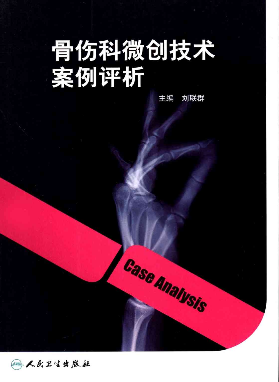 骨伤科微创技术案例评析